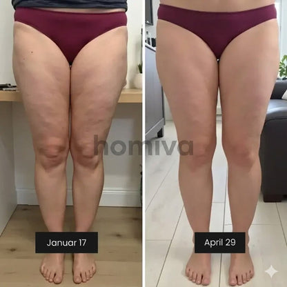 3D Anti-Cellulite Leggings HomivaRitual