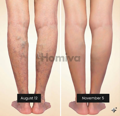 3D Anti-Cellulite Leggings HomivaRitual